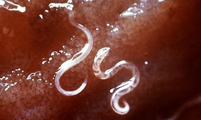 What are parasites in human liver